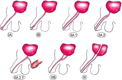 Urethral multiplicity in boys: systematic review of case reports and case series from the last 15 years